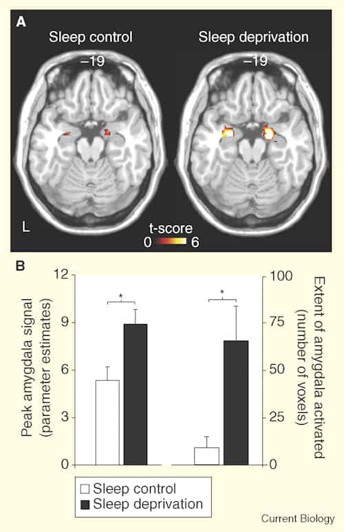 Here’s What Happens When You Don’t Sleep Enough